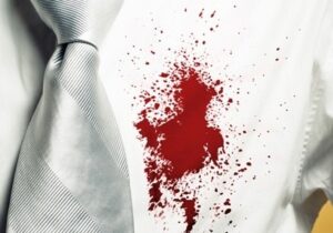 لکه، لکهی روی لباس، لکه خون روی لباس